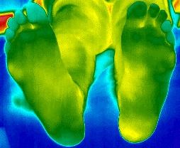 Wärmebilder der Fusssohlen und Fussrücken zum Vergleich der Temperaturverteilung
