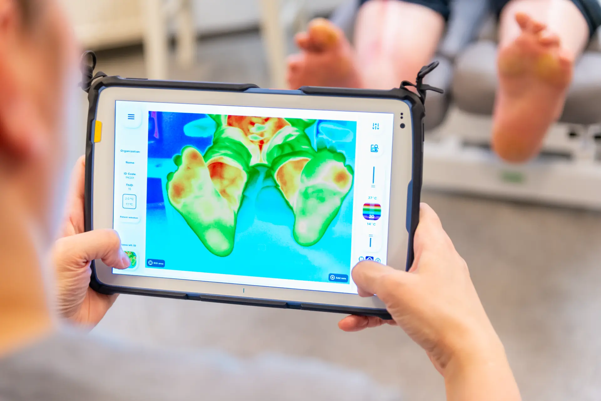 Fachperson erfasst mit dem Thermidas-Tablet ein Wärmebild des Patientenfusses