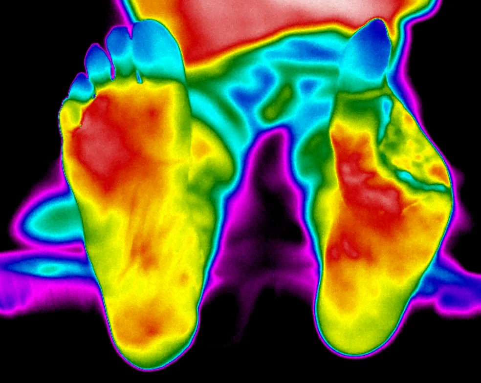 07/2022 · nach Amputation: Wunde heilt, keine Entzündungszeichen; Hallux weiterhin kühler